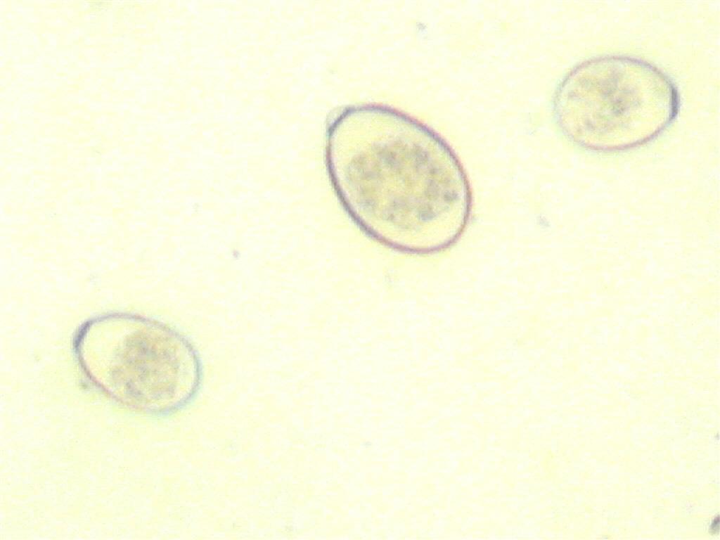 coccidia - HORSE PARASITE, HORSE PARASITE TESTING, FECAL EQUINE PARASITE